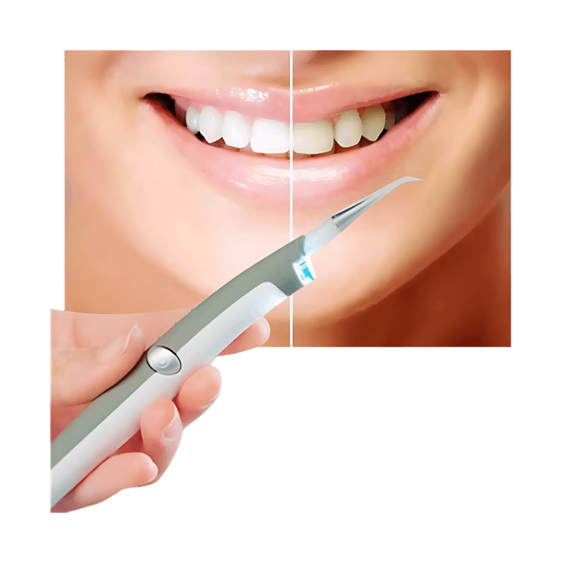 Dental Cleaning System for Ultimate Oral Care at Home